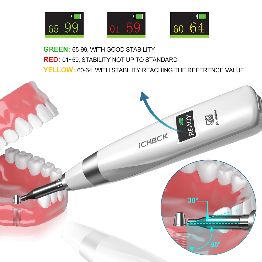 AI Dental Implant Stability Me - Stabilizer Screw In recension och pris